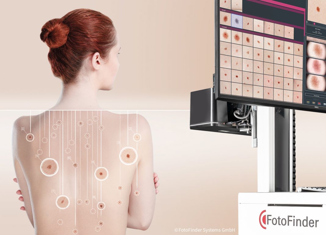 FotoFinder_ATB-master_Launch_WCD-2019