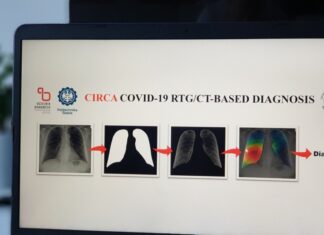 Stworzone w Polsce technologie rozpoznają koronawirusa na zdjęciu rentgenowskim czy tomografii komputerowej