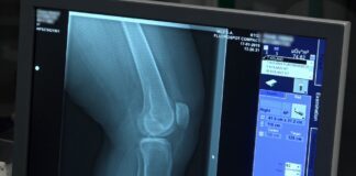 W wyniku pandemii tysiące chorych na osteoporozę pozostają bez pomocy. Lekarze i pacjenci apelują o proste zmiany umożliwiające diagnostykę i leczenie [DEPESZA]